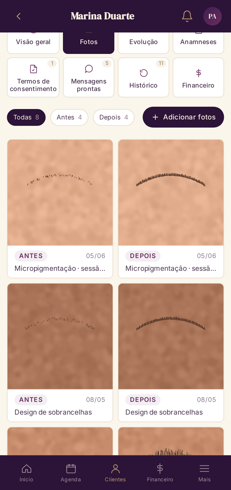 Evolução do cliente com fotos no Vênus Control
